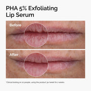 Before and After graphic showing smoother less flakly lips after using PHA 5% Lip Exfoliating Serum